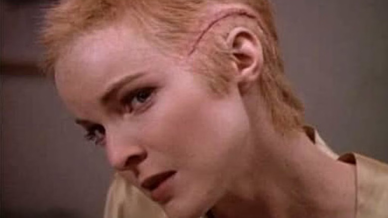 Dr. Kimberly Shaw reveals her surprise head scar on Melrose Place