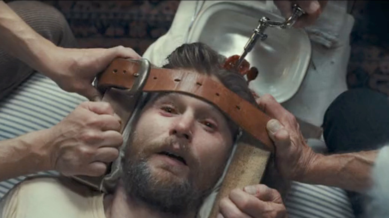 1923 Brain Surgery