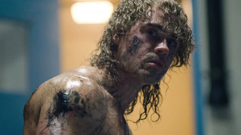 A sweaty Billy Hargrove (Dacre Montgomery) stands with his infections visible in Stranger Things