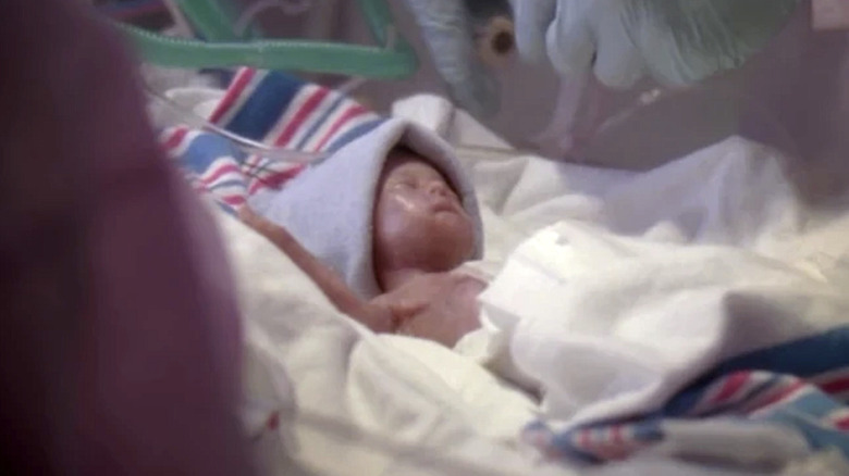 An infant being operated on in "Grey's Anatomy"