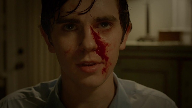 Freddie Highmore with blood on his face as Norman Bates in Bates Motel