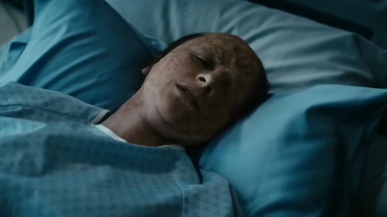 Stormfront lying in a hospital bed