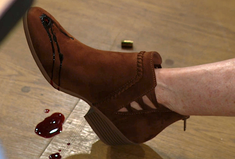 sheila shot toe 1240x840