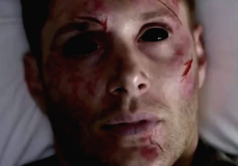 2014_Supernatural_DDean