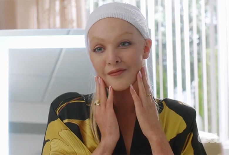 Dynasty Alexis Recast