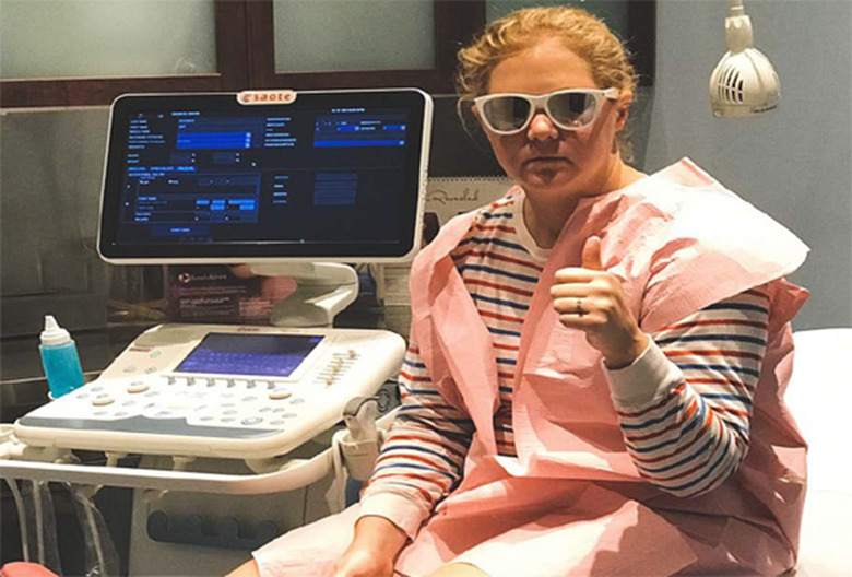 Amy Schumer Pregnancy